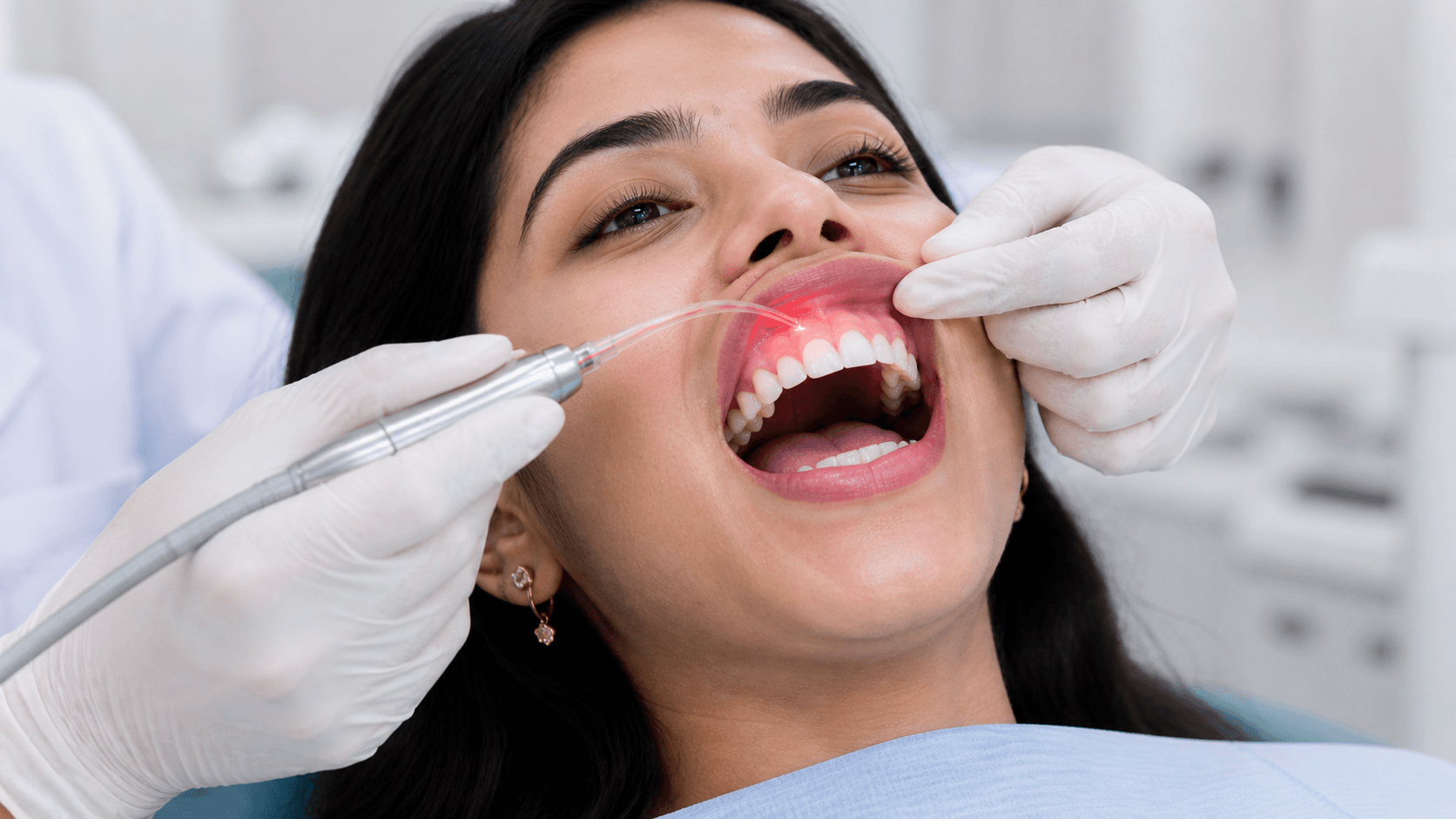 Laser Treatment 